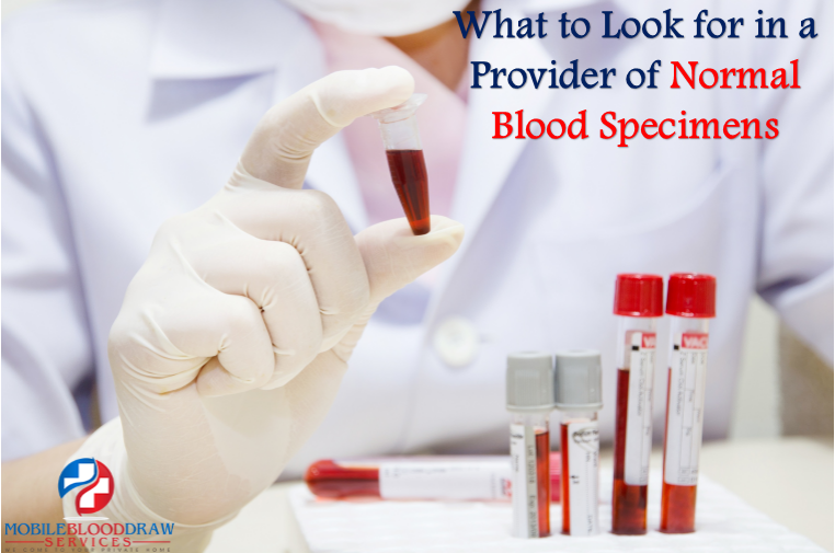Best Blood Laboratories Washington Metropolitan Area